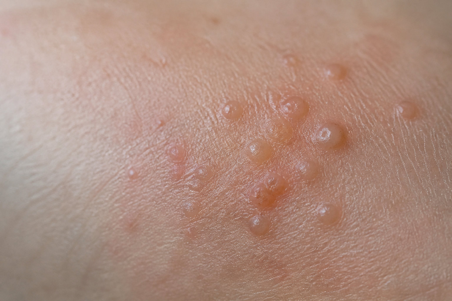 Causes médicales fréquentes des démangeaisons aux mains