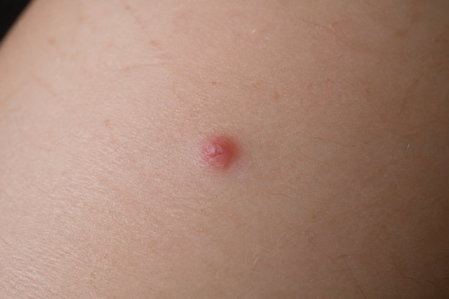 Quand faut-il s'inquiéter pour sa santé capillaire ?