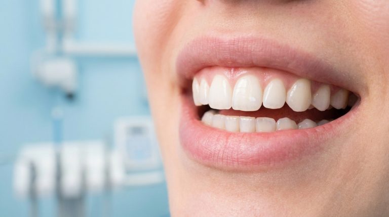 Gros plan sur le sourire d'une personne avec des dents blanches dans un cabinet dentaire.